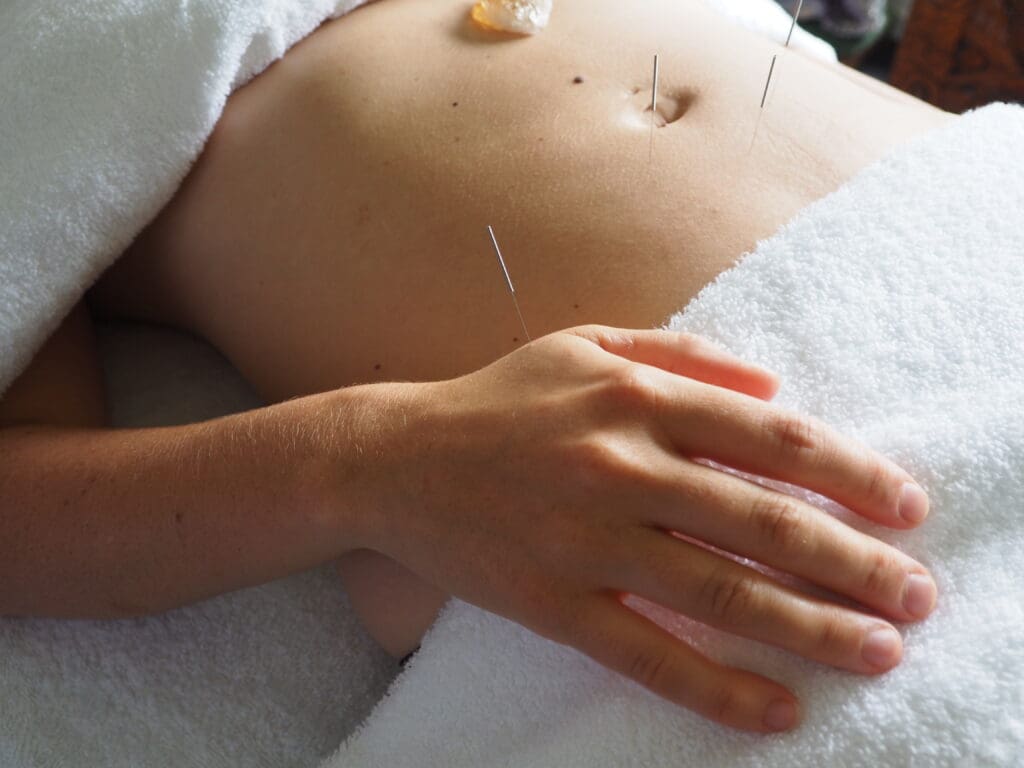 Acupuncture for pelvic pain